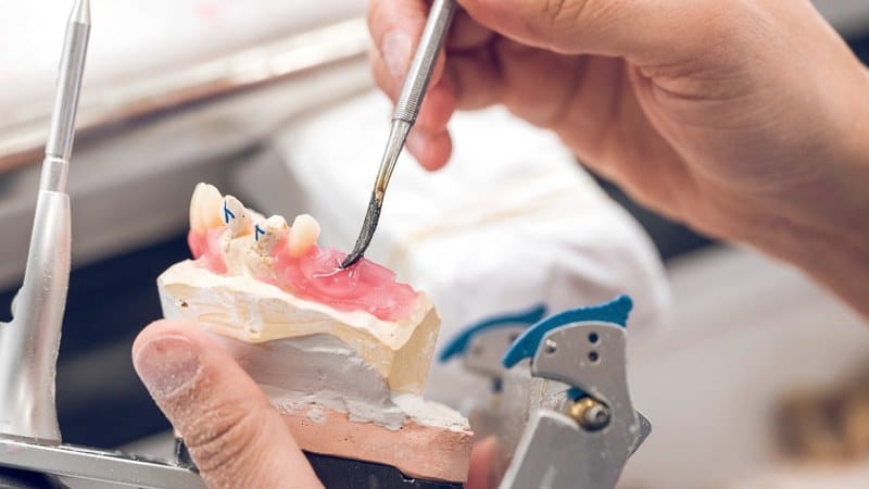 Dental technician setting a denture tooth into wax with a spatula